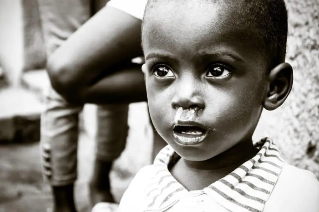 découvrez les causes, les effets et les solutions à la malnutrition. informez-vous sur les défis nutritionnels mondiaux et comment améliorer la santé pour tous.